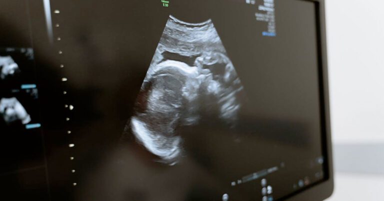 ultrasound_natural_thumbnail