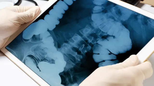 toulouse-man-ww1-bomb-anus