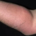 Sperm-Arm_