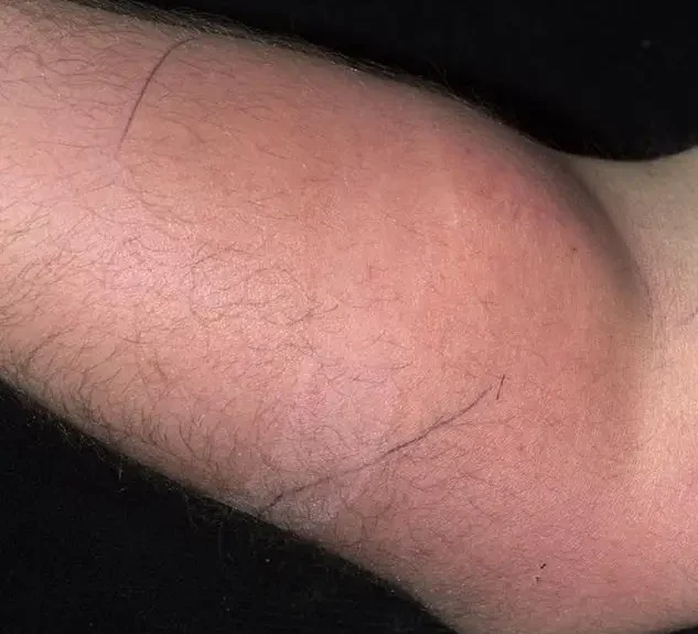 Sperm-Arm_